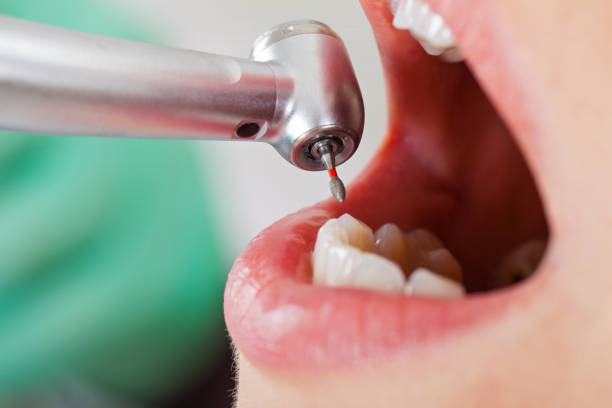 Best Urgent Tooth Repair  in Avenue B And C, AZ